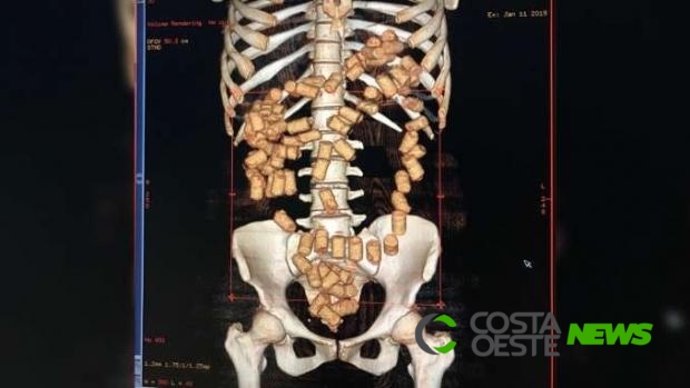 Com drogas no estômago, estudante de direito é detida no aeroporto de Foz