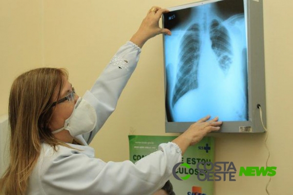 Casos de tuberculose sobem no Paraná e acendem o alerta