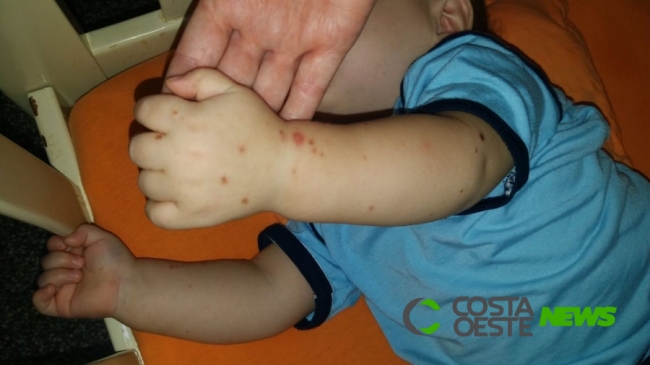 Surto de doença viral paralisa atividades de segunda creche na região