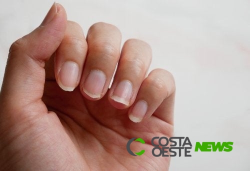 4 ingredientes naturais para tratar unhas quebradiças