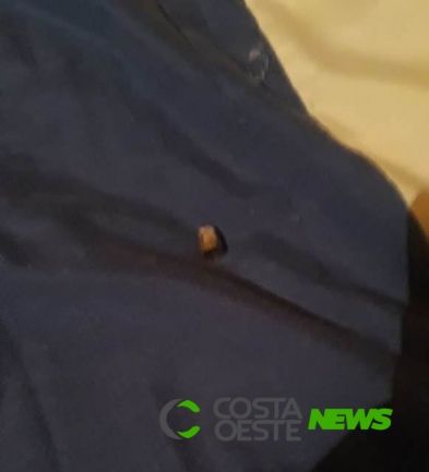 Adolescente é atingido no nariz de raspão por bala perdida enquanto dormia em Foz do Iguaçu