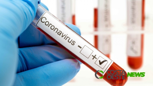 Jovem de 23 anos é segundo caso confirmado de Coronavírus em Cascavel