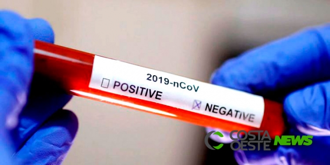 COVID-19: Exames apontam resultado negativo em dois casos suspeitos de São Miguel 