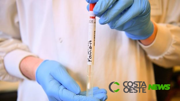 Foz confirma mais três casos de Covid-19 e número sobe para 35