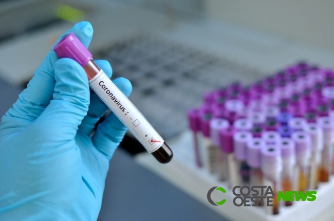 Saúde confirma 10 novos casos de Coronavírus em Foz
