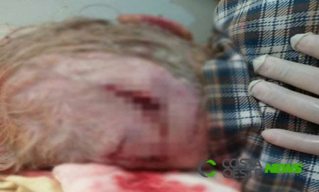 Idosa é agredida com cadeira e tem objetos roubados em Guaíra; suspeito foi preso