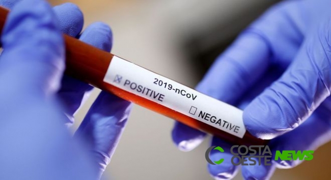 Casos confirmados de Covid-19 em São Miguel tiveram contato com confirmado de Medianeira