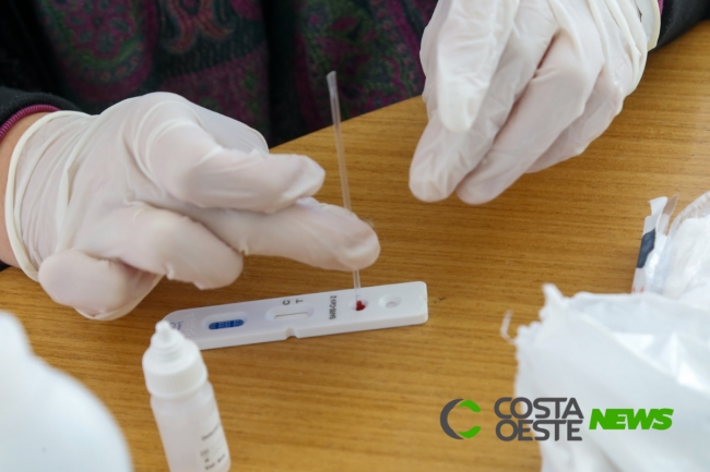 Estado distribui mais 178 mil testes rápidos aos municípios
