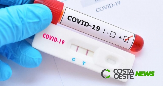 Testes rápidos para Covid-19 apresentam taxa de erro de até 75%, afirma especialista