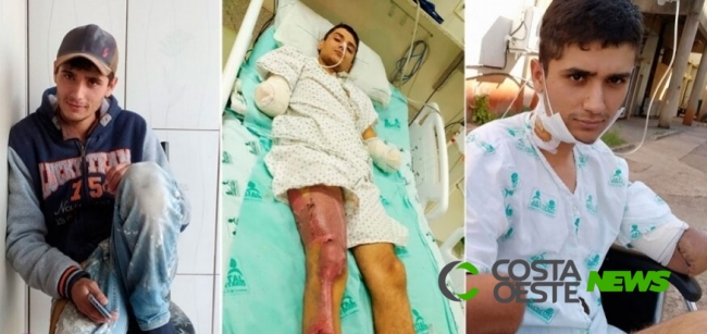 Vakinha e rifa buscam auxiliar  Arthur Zigliolli em seu tratamento de saúde, após acidente de trabalho