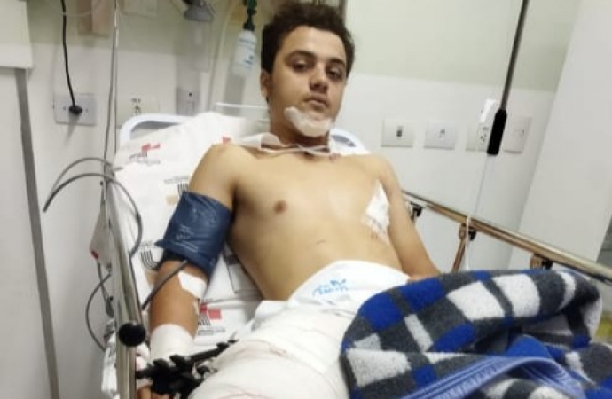 Família promove jantar dançante em prol de jovem que sofreu acidente de moto