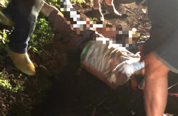 Motociclista tem fratura exposta após acidente na PR 317 em Santa Helena