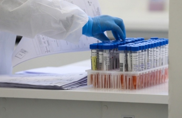Secretaria de Saúde confirma caso da Influenza H3N2 em Santa Helena