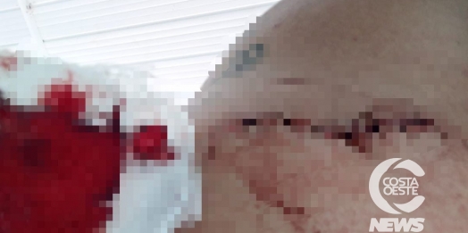 Homem leva facada e apanha de rodo em Vila Celeste, interior de Santa Helena