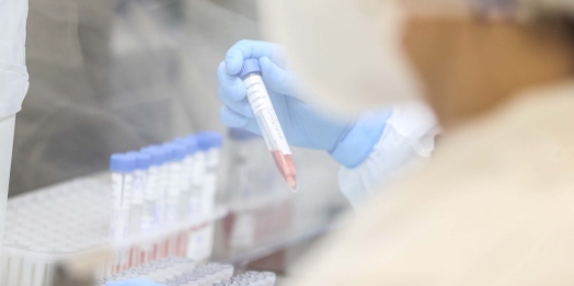 Paraná registra 262 casos de Influenza H3N2; transmissão da doença é considerada comunitária