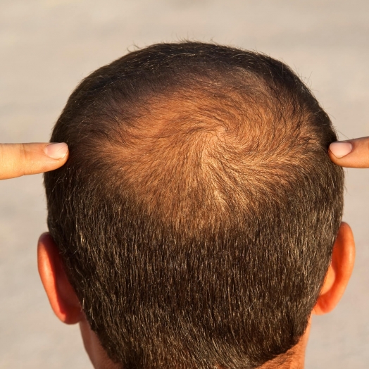 Beleza Masculina: cresce a procura  por tratamentos estéticos nos últimos meses