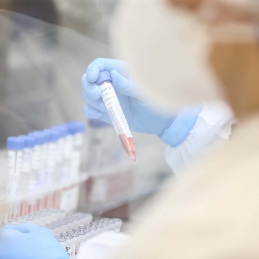 Paraná registra 262 casos de Influenza H3N2; transmissão da doença é considerada comunitária